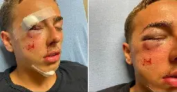 'It reflects some serious problems' | Attorney for alleged police assault victim speaks out