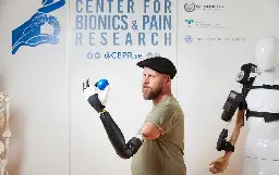 Above-Elbow Bionic Arm Can Control Every Finger