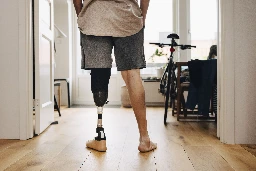 Health Insurers Limit Coverage of Prosthetic Limbs, Questioning Their Medical Necessity