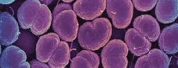 Gonorrhea is becoming unstoppable; highly resistant cases found in US