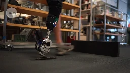 Bionic leg moves like a natural limb — without conscious thought