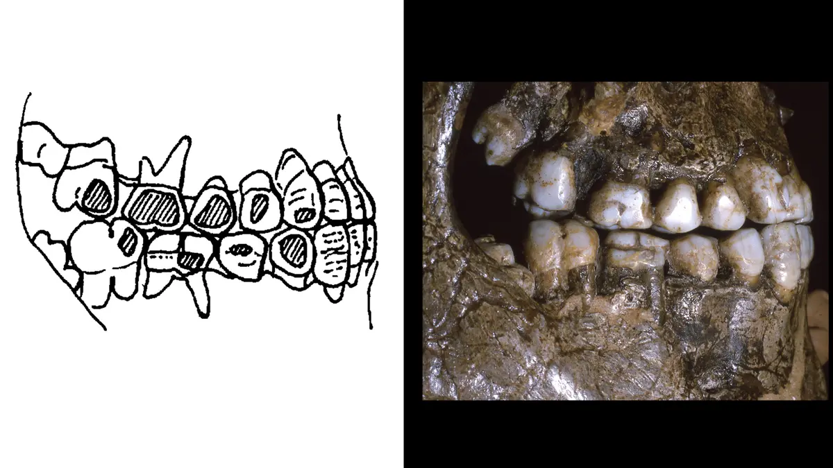 Ice age Europeans as young as 10 years old rocked cheek piercings 30,000 years ago