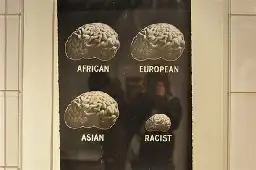 Brain size