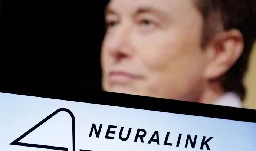 Brain chips to be tested on humans this year, Elon Musk says