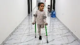 The Children Who Lost Limbs in Gaza