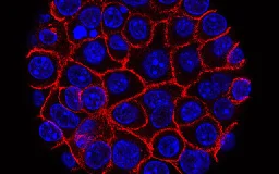 Newfound mechanism suggests drug combination could starve pancreatic cancer