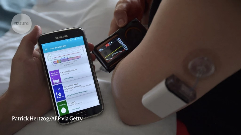 A DIY ‘bionic pancreas’ is changing diabetes care — what's next?