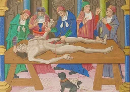 Medieval physicians performed a vivisection on a living patient, study finds - Medievalists.net