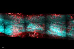 Understanding rapid tendon regeneration in newts may one day help human